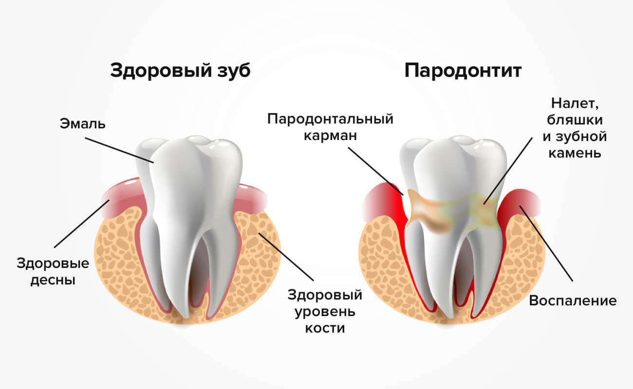 пародонтология<br>